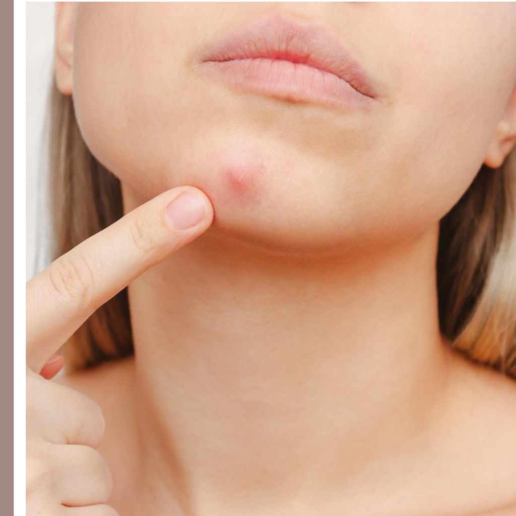 εσωτερικά σπυράκια σαν καρούμπαλα