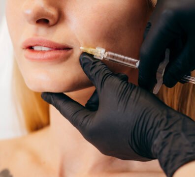 υαλουρονικό