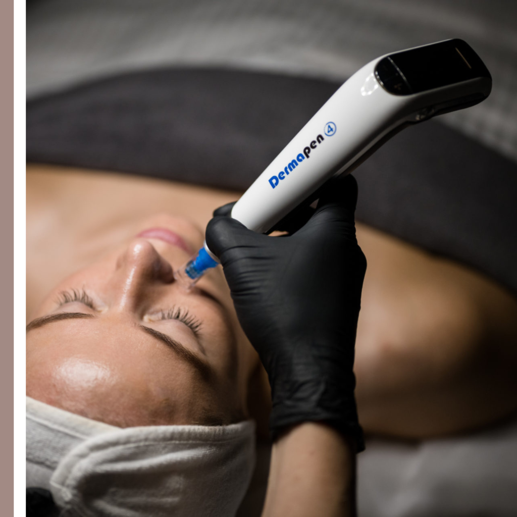 Dermapen microneedling