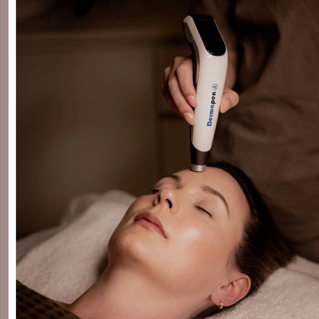 Dermapen πόσο συχνά
