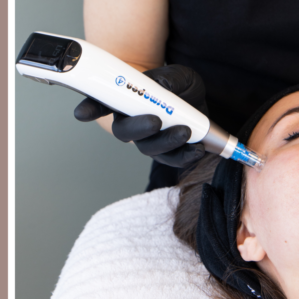 Dermapen τι είναι