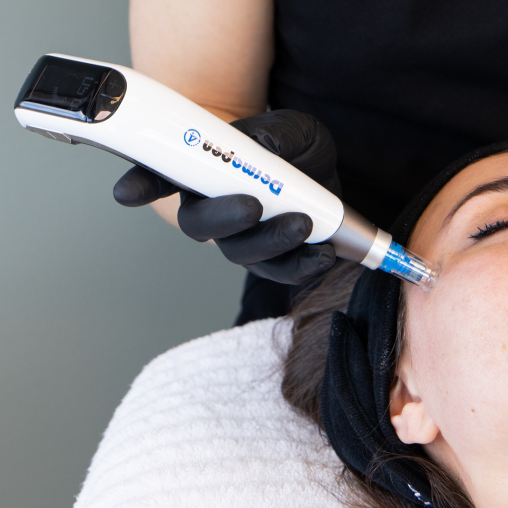 Dermapen τι είναι