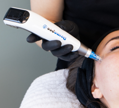 Dermapen τι είναι