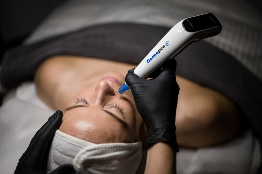 Dermapen microneedling