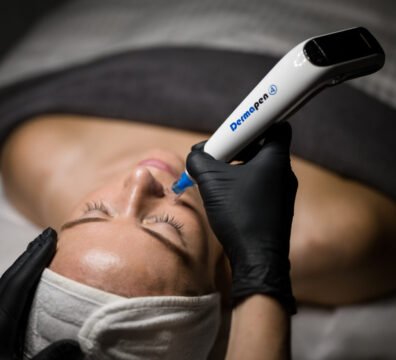 Dermapen microneedling