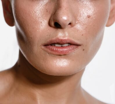 πολύ μικρά άσπρα σπυράκια στο πρόσωπο