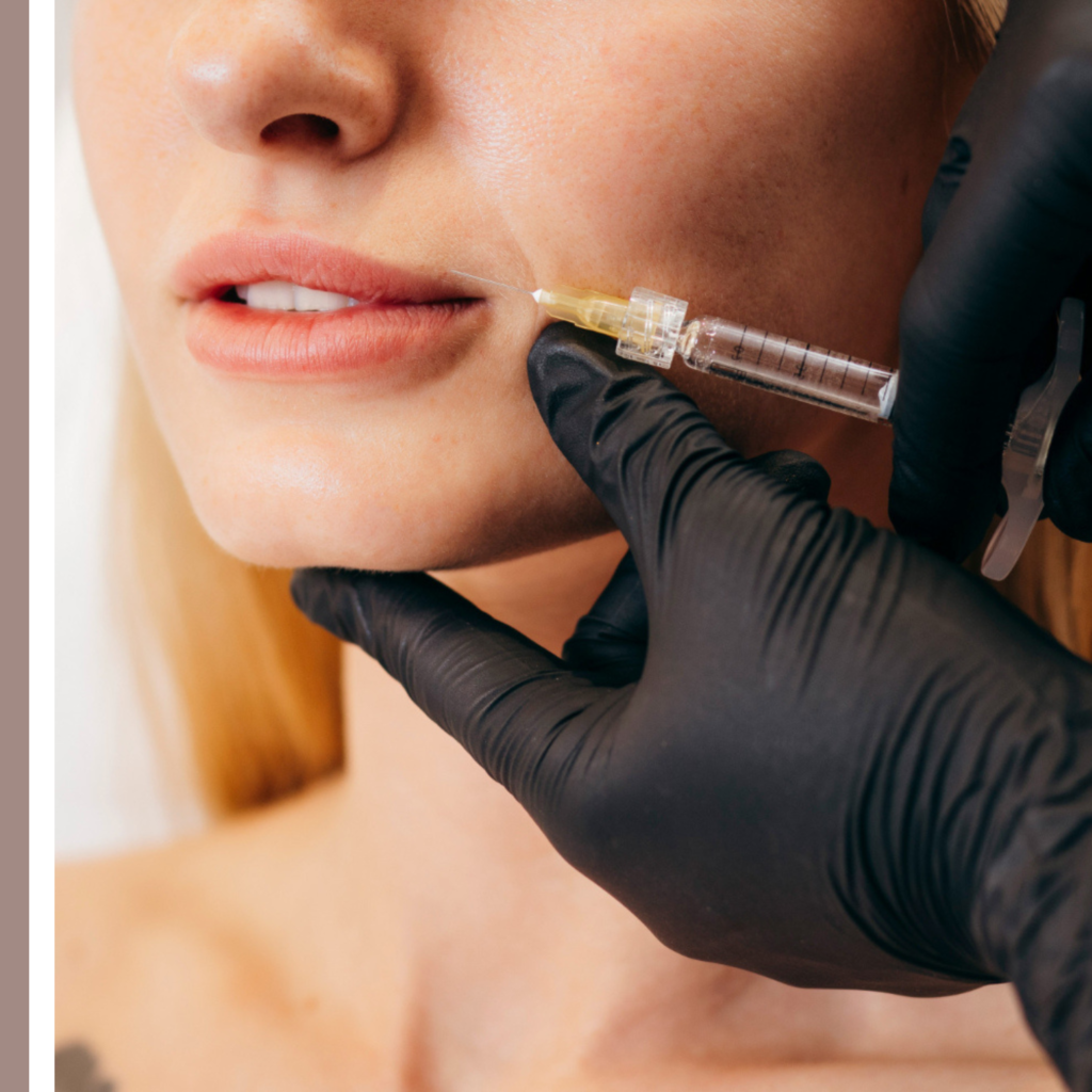 υαλουρονικό