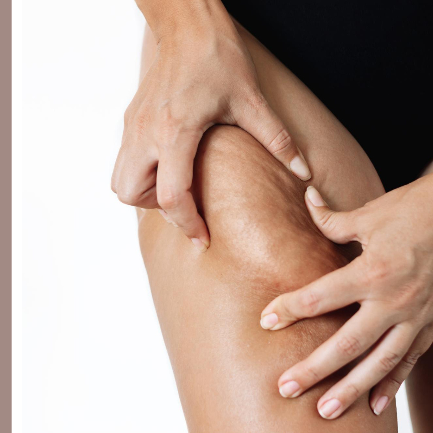 η καλύτερη κρέμα για κυτταρίτιδα και σύσφιξη