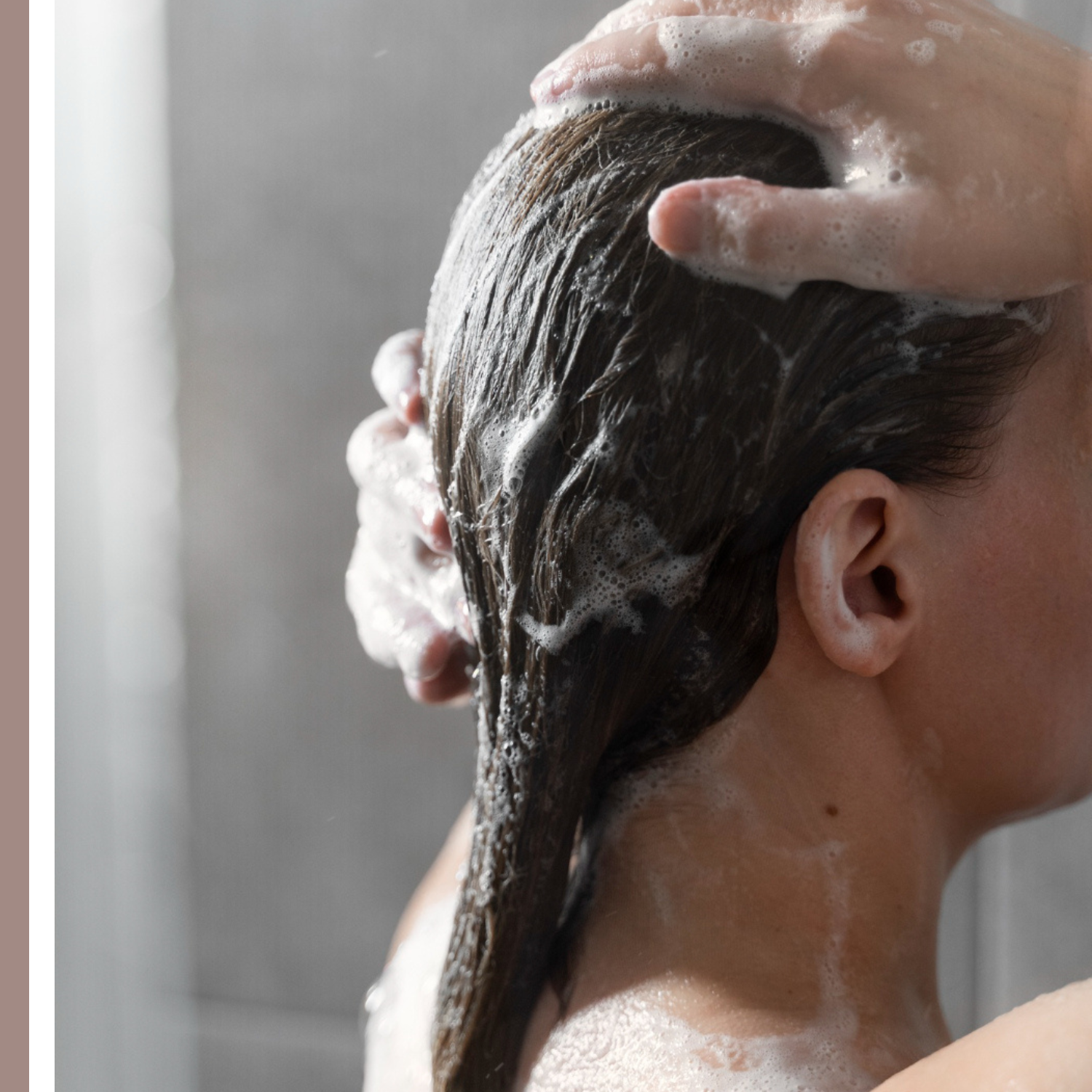 σαμπουάν σμηγματορροϊκή δερματίτιδα