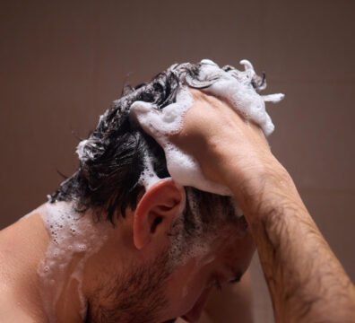 τα καλύτερα σαμπουάν για σμηγματορροϊκή δερματίτιδα