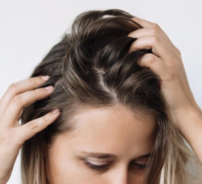 λιπαρά μαλλιά