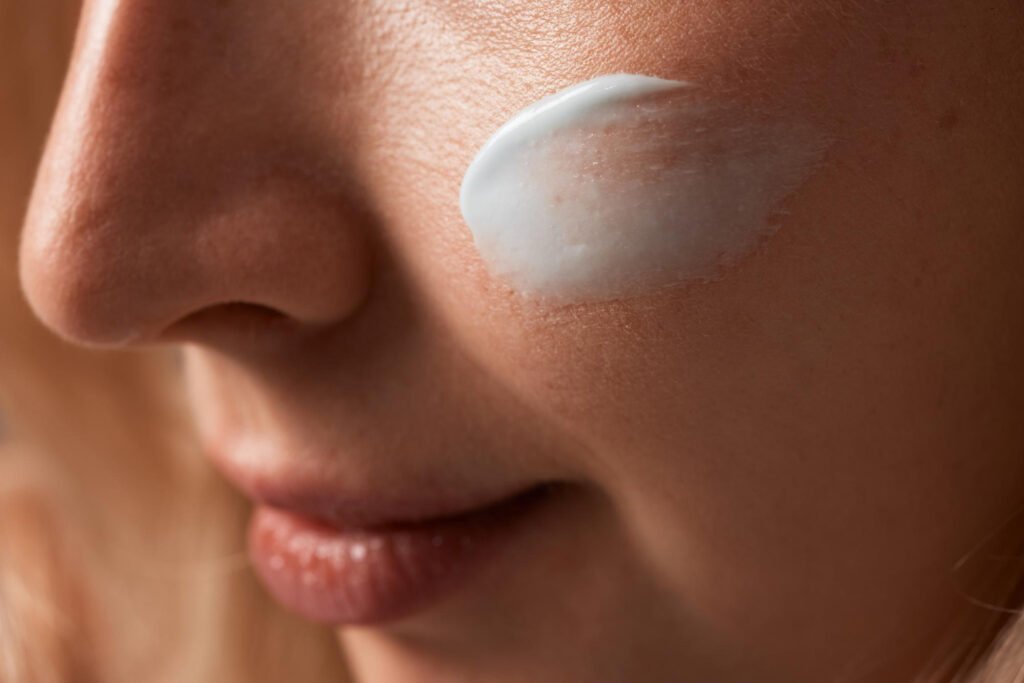 αντηλιακά για ακμή