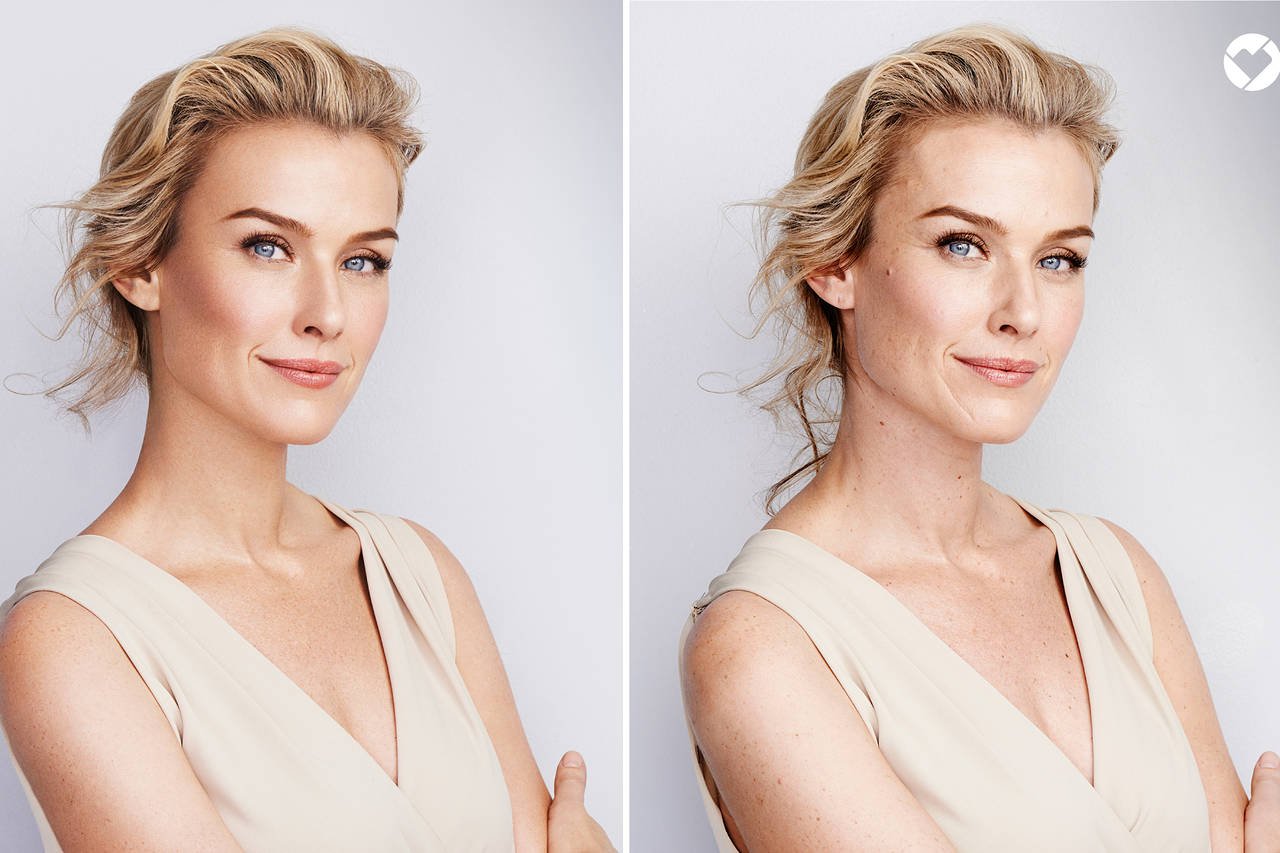 Αισθητική ιατρική & social media: Δύο βίοι παράλληλοι