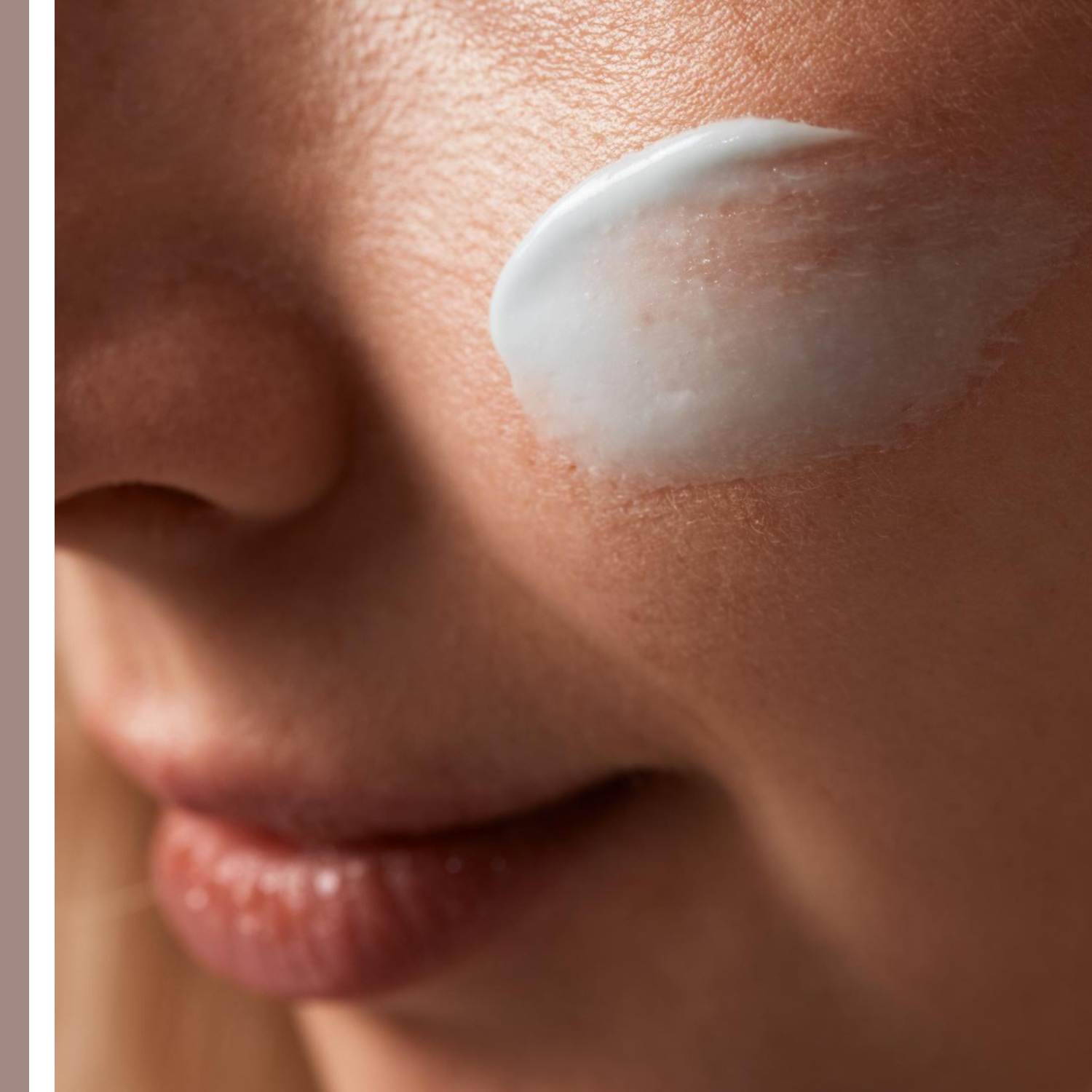 αντηλιακά για ακμή