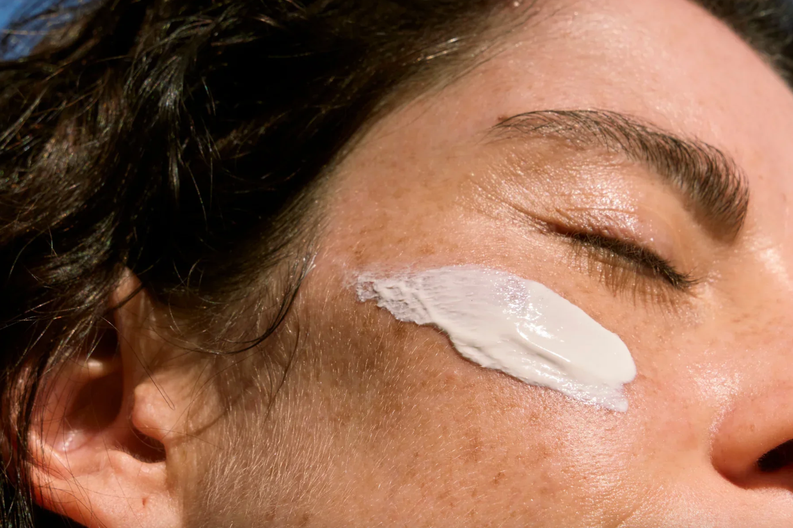 αντηλιακό για ακμή