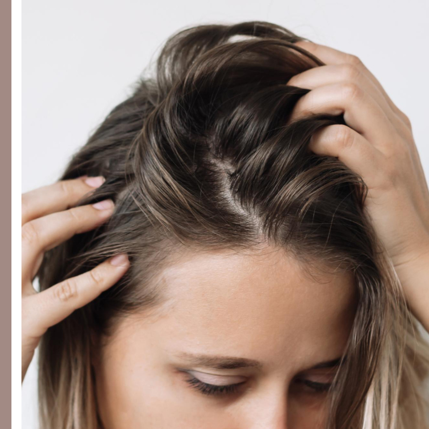 λιπαρά μαλλιά