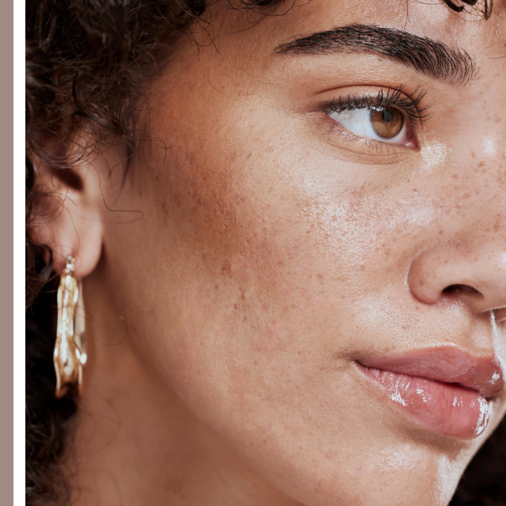 τραχύ δέρμα προσώπου