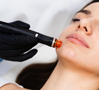 Hydrafacial