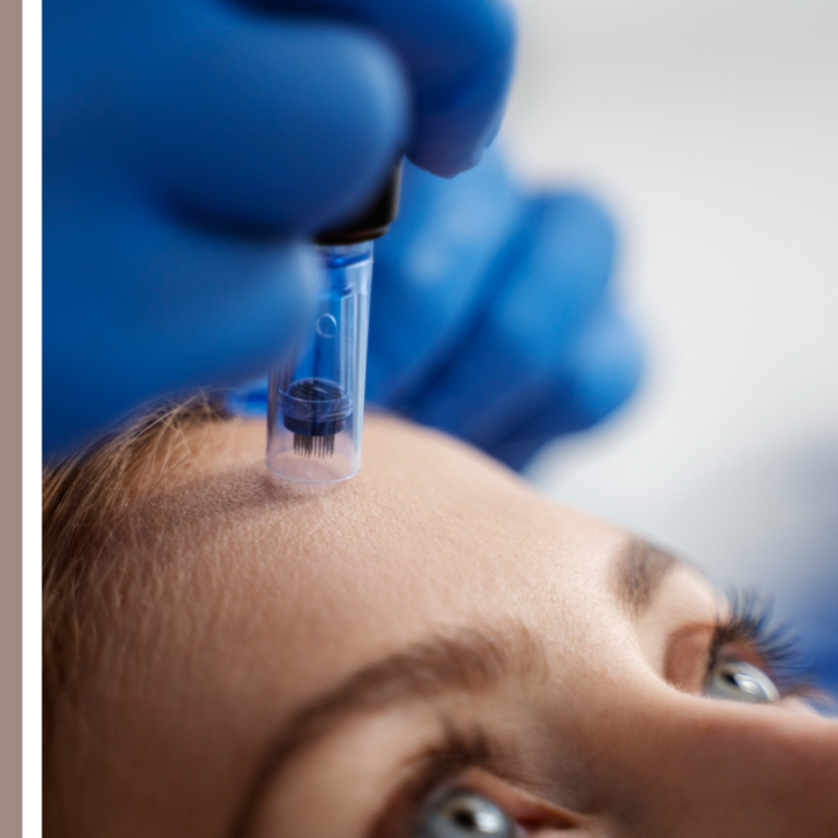 microneedling παρενέργειες
